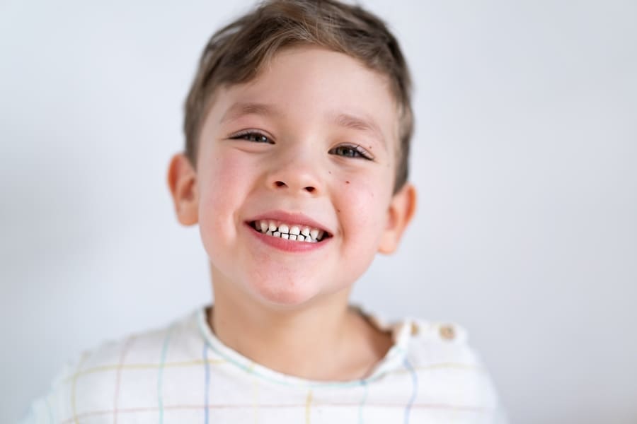 salud dental infantil - Servicio Murciano de Salud - Programa de Salud Bucodental Infantil